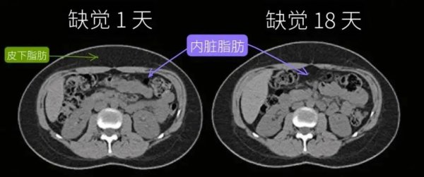 金贝街 这样睡觉, 真的能减肥!